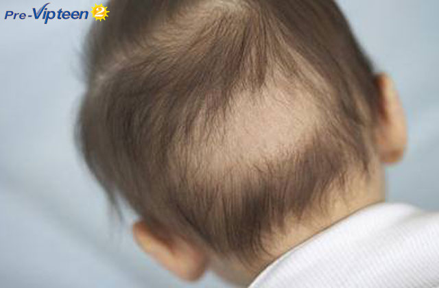 Hiện tượng rụng tóc ở trẻ sơ sinh