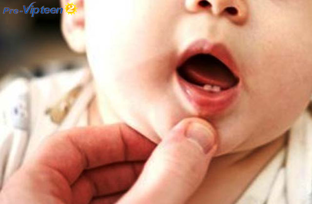 Mọc răng chậm có phải bé thiếu canxi